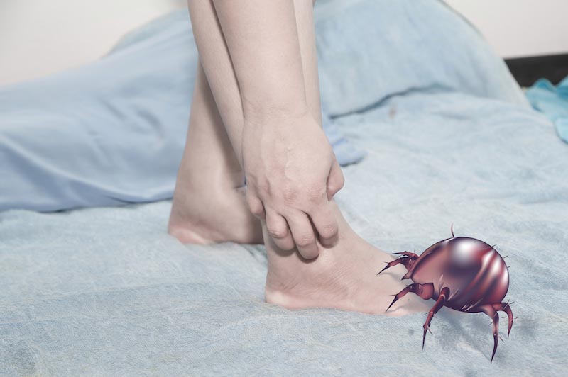 症状図解あり ダニと蚊やノミ 南京虫の刺され方の違いや見分け方 ハウクリ部