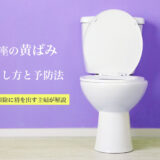 トイレの便座の黄ばみの落とし方と予防法
